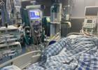 省医帮扶丨县人医多学科联合成功抢救一名重症胰腺炎患者