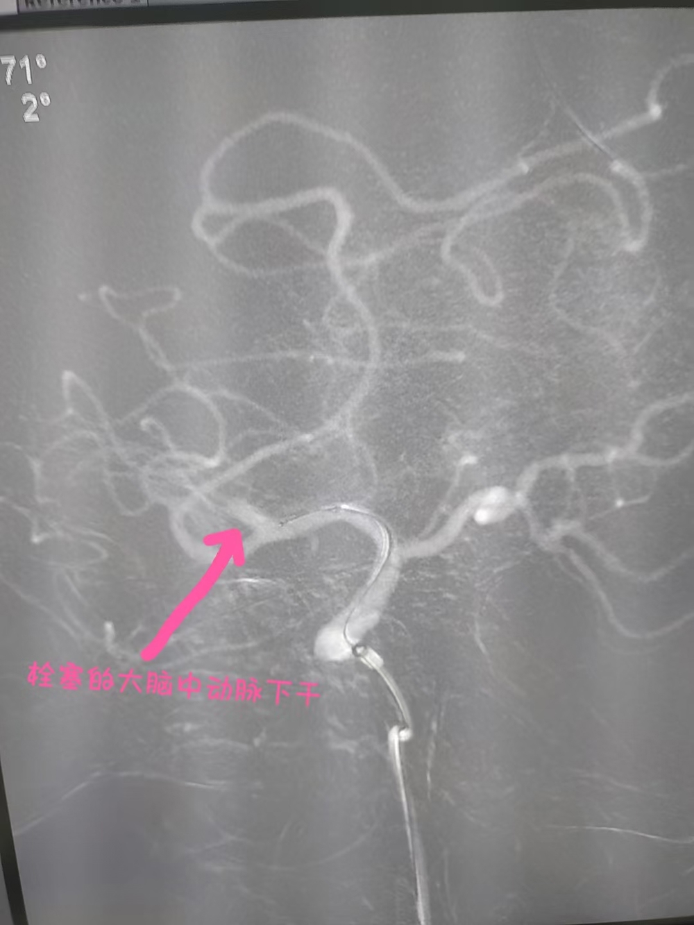 D:\微信\WeChat Files\wxid_5yyipnjt9qg522\FileStorage\Temp\e9b5fea618776f2df6b4fa63353d24f.jpg