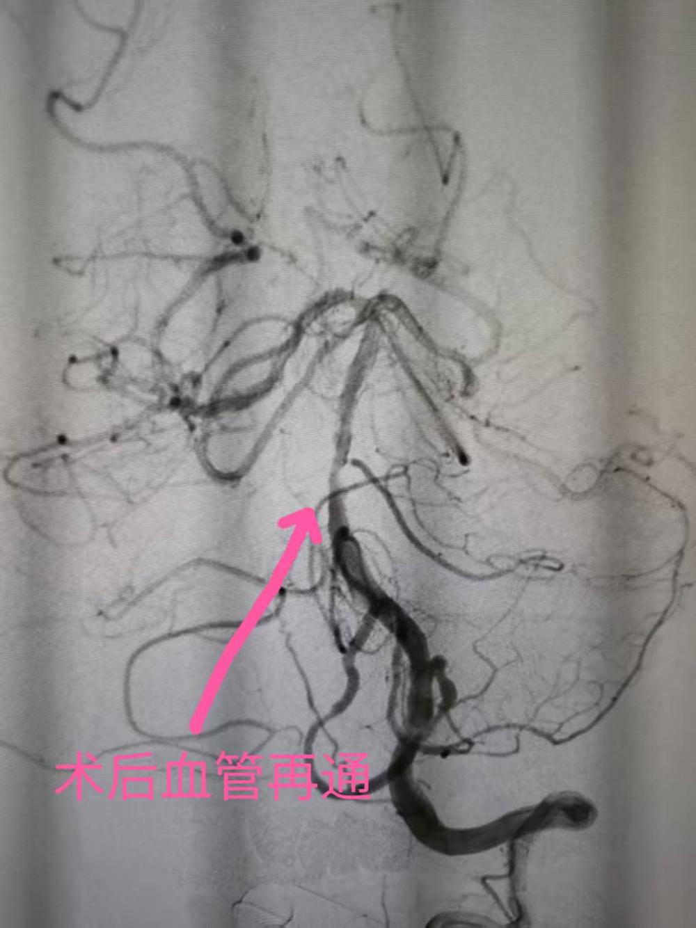 239a455f1bfc95fe1d448c5a730518b