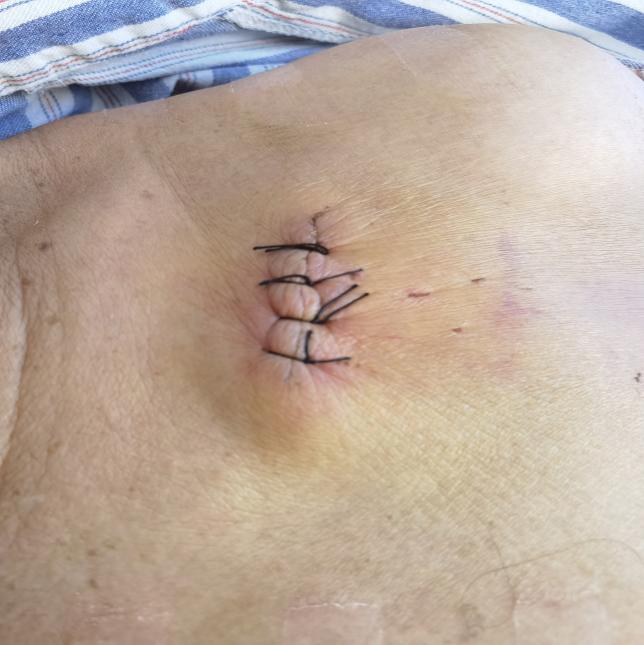 811c26e0157f444b6de46ef068d3f74