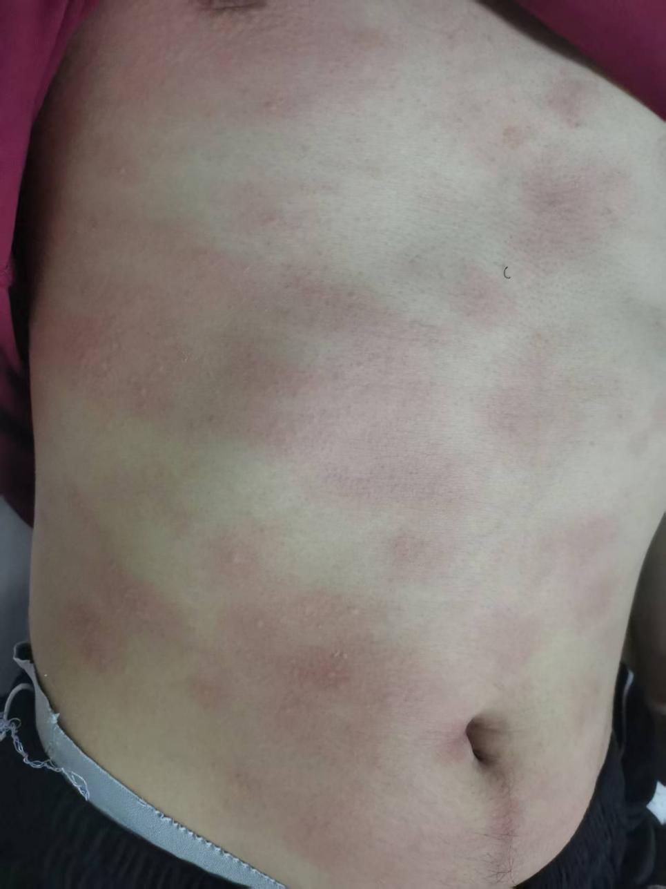 7056ef358a92052c213d7244436a48c