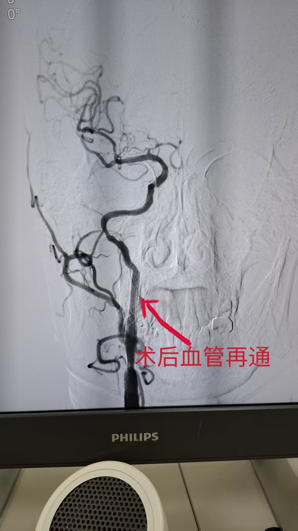 53e1e6d654aaeee35a3dd6af5b52b8c