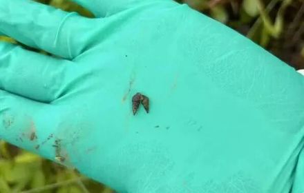 血吸虫是这样一步步潜伏、入侵人体的！但简单几步就能远离侵袭→