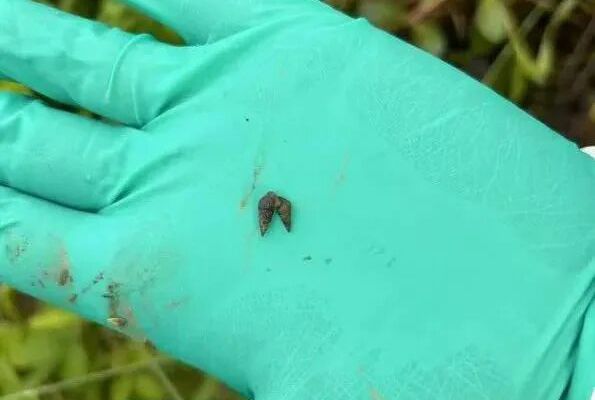 血吸虫是这样一步步潜伏、入侵人体的！但简单几步就能远离侵袭→