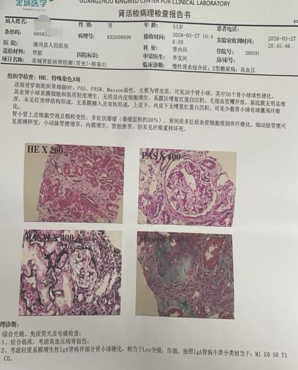 fee92ec6ac737af4d5063f978dad47ec