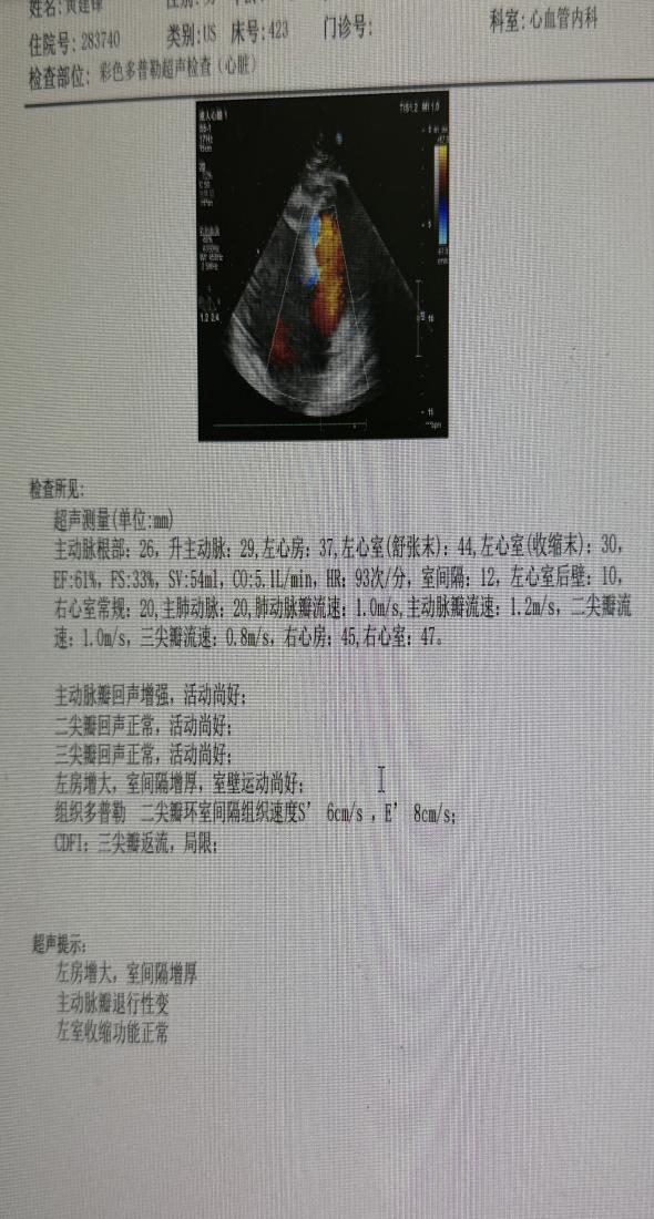 09234ab06b1e51adcfbba7c3ac842494